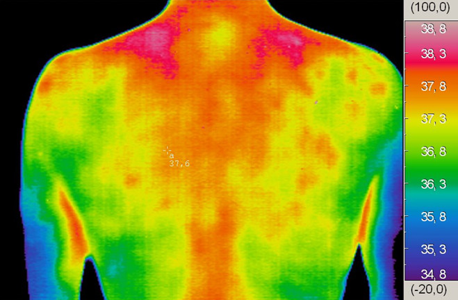 Medical Thermography Camera